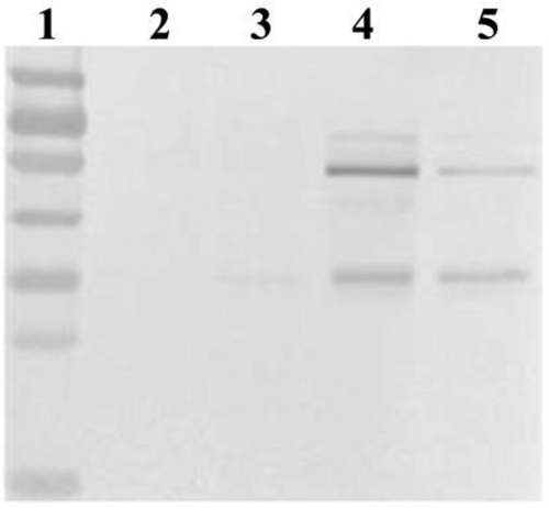Figure 4. Detection by Western blotting of intracellular lipase in four recombinant strains.