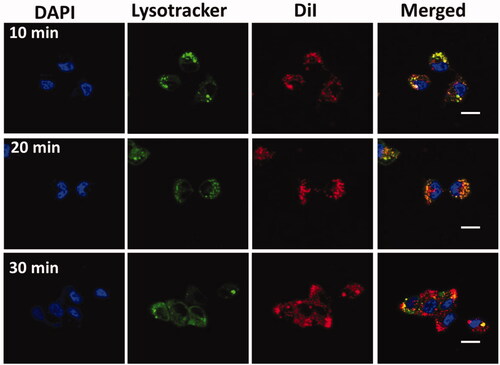 Figure 3. Subcellular localization of GEM-NPs with lysosomes in B-CPAP thyroid cancer cell lines at 10, 20, and 30 minutes incubation time. Scale bar = 20 μm.