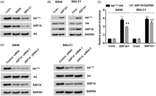 Figure 1. ASF1A expression is positively correlated with H4Y72ph levels in colon cancer cells. (A) Expression of H4Y72ph and ASF1A in different cell lines (LoVo, SW48 and SNU-C1) were detected by western blot. (B and C) Effects of ASF1A overexpression in regulation of H4Y72ph were detected by western blot. (D) Using interference RNA to silence ASF1A expression and detected the influence on H4Y72ph in different cell lines (SW48 and SNU-C1) by western blot. All the data were presented by mean + SD (n = 3). ** p < .01; *** p < .001 (to control in H4Y72ph/H4); ## p < .01 (to control in ASF1A/GAPDH).