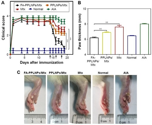 Figure 5 Anti-arthritic efficacy of FA-PPLNPs/Mtx, PPLNPs/Mtx and free Mtx in AIA rats. (A) Scores of RA in days after administration of FA-PPLNPs/Mtx, PPLNPs/Mtx, free Mtx and saline. **P<0.01. (B) Paw thickness after all treatments. (C) AIA rat paws from the different AIA groups. Copyright © 2017. Dove Medical Press. Reprinted from Zhao J, Zhao M, Yu C, et al. Multifunctional folate receptor-targeting and pH-responsive nanocarriers loaded with methotrexate for treatment of rheumatoid arthritis. Int J Nanomedicine. 2017;12:6735-6746.Citation173Abbreviations: RA, rheumatoid arthritis; MTX, methotrexate.
