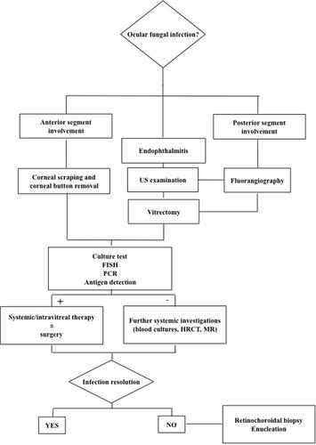 Figure 1 Flowchart of diagnostic approach in suspected ocular fungal infection.