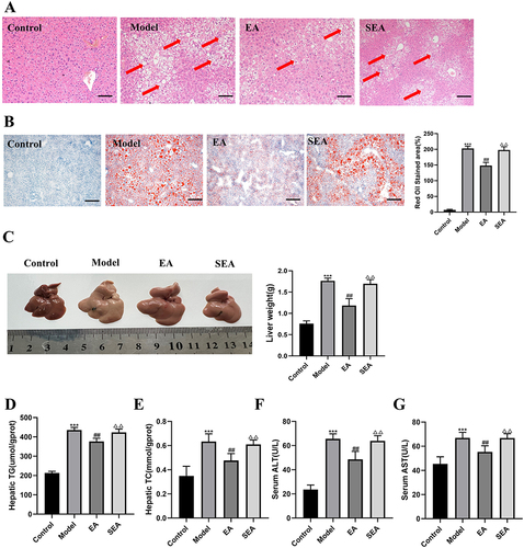 Figure 2 EA improves liver steatosis and liver function in mice (A) H E staining of liver tissue (scale bar = 200 µm). The red arrows indicate typical hepatic inflammation. (B) Liver tissue stained with Oil Red O (scale bar = 200 µm). (C) Morphology of liver. (D) Hepatic TG. (E) Hepatic TC. (F) Serum ALT. (G) Serum AST. n= 6, values are mean ± SEM; *** p < 0.001 (Control vs Model); ## p < 0.01 (Model vs EA); ΔΔ p < 0.01 (EA vs SEA).