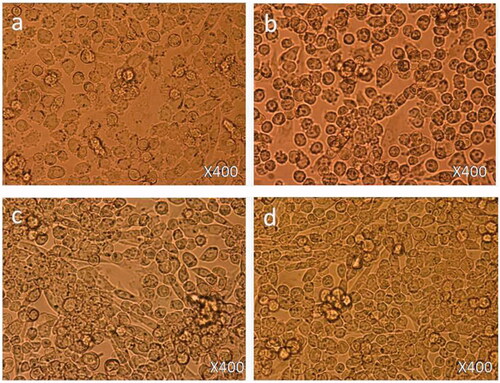 Figure 2. Cell morphology: the HCT-116 cells were non-treated (a) and treated with FMSP-nanoparticles (1.25 μg/mL) for 6 h (b), 24 h (c) and 48 h (d). 400× magnification.