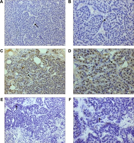 Figure 4 Immunohistochemical staining of HIF-1α.