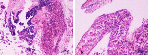 Figure 2.  Jejunum cross-section obtained from a 23-day-old broiler chicken, challenged with C. perfringens and E. maxima. Marked inflammatory reaction was observed, which consisted of infiltration of heterophilic granulocytes and lymphocytes. Moreover, the presence of large numbers of rod-shaped bacteria as clusters (2a) or individually (2b) was detected at the intestinal lumen and mucosa (haematoxylin and eosin).