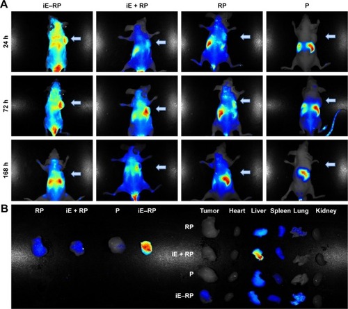 Figure 5 Real-time NIR fluorescence images of iE–RBCm–PLGA NPs.Notes: (A) Images of Caco-2 tumor-bearing mice following intravenous injection of DiR-labeled iE–RBCm–PLGA NPs (iE–RP), RBCm–PLGA NPs with free anti-EGFR-iRGD protein (iE + RP), RBCm–PLGA NPs (RP), and PLGA NPs (P) for 24, 72, and 168 h. (B) Images of various organs at 168 h postadministration with four different NPs (iE–RP, iE + RP, RP, and P).Abbreviations: DiR, 1,1′-dioctadecyl-3,3,3′,3′-tetramethylindotricarbocyanine iodide; NIR, near-infrared; NPs, nanoparticles; PLGA, poly(lactic-co-glycolic acid); RBCm, red blood cell membrane.