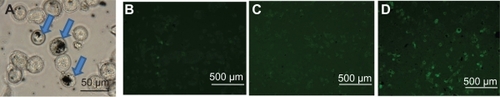 Figure 4 A) Optical image showing uptake of f-SWCNT-p53 complex by MCF-7 cells and agglomeration of f-SWCNT_p53 complex; B–D) Expression of GFP tagged p53 and f-SWCNT complex in MCF-7 cells after 24, 48, and 72 hours of incubation with 20 μg mL−1 of f-SWCNTs and 2.7 μg mL−1 of GFP tagged p53 at 37°C and 5% CO2 atmosphere. The arrows indicate the presence of nanotubes inside the cells.Abbreviations: f-SWCNT, functionalized single-walled carbon nanotubes; GFP, green fluorescent protein.