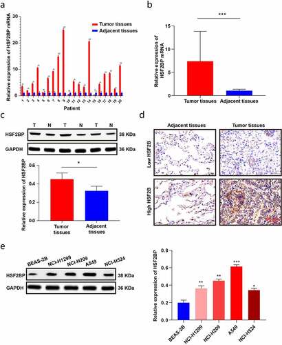 Figure 2. The expression of HSF2BP in LUAD tissues and cells. (a-b) The mRNA expression of HSF2BP in LUAD and normal tissues. (c) The protein expression of HSF2BP in LUAD and adjacent tissues which was detected by western blot. (d) The protein expression of HSF2BP in LUAD and adjacent tissues which was detected by IHC. (e) The protein expression of HSF2BP in LUAD cell lines and BEAS-2B. Note: * p < 0.05, ** p < 0.01, *** p < 0.001.