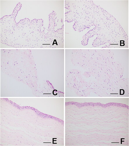 Figure 4. Light microscopy of rabbit’s iris (A, B), rabbit’s conjunctiva (C, D), and rabbit’s corneal tissue sections (E, F), from CsA emulgel-treated (OD) and control (OS) rabbit eyes. Samples and tissue sections from treated eyes showed no alterations in morphological details compared to control eyes. Eye tissues from CsA emulgel-treated animals gave similar results. Staining: (A–F) hematoxylin-eosin. Scale bar = 100 μm.