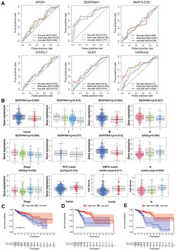Figure 2 ROC curve analysis for ARGs and clinical prognostic diagnostic value of ARGs in COAD and the relationship between SERPINA1 and OS, RFS, and DMFS. (A) ROC curve analysis to determine the potential diagnostic value of the risk ARGs in COAD. The ROC curve plots for 5-years survival rate: GRID1 (AUC = 0.507), SERPINA1 (AUC = 0.751), MAPILC3C (AUC = 0.500), CX3CL1 (AUC = 0.574), ULK3 (AUC = 0.613), risk Score (AUC = 0.737). (B) Clinicopathological significance of the prognostic index of COAD (p<0.05). (C) Kaplan–Meier curve estimated the relationship between SERPINA1 and overall survival (OS). (D) Kaplan–Meier curve estimated the relationship between SERPINA1 and RFS. (E) Kaplan–Meier curve estimated the relationship between SERPINA1 and distant metastasis-free survival DMFS. The Log rank test was performed to test the statistical significance.