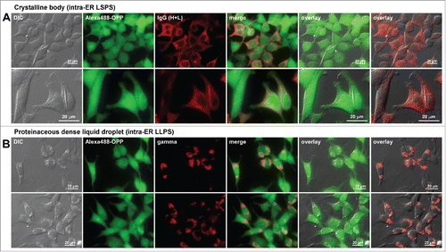 Figure 9. Protein translation is not attenuated in cells showing different classes of immunoglobulin inclusion body phenotype. Fluorescent micrographs of HEK293 cells expressing (A) a human IgG4 clone that induces crystalline body via intra-ER liquid-solid phase separation (LSPS)Citation29 and (B) a scFv-Fc construct that induces morula cell phenotype via intra-ER liquid-liquid phase separation (LLPS).Citation39 Transfected cells were first labeled for 30 min using Alexa Fluor 488 Click-iT® Plus OPP reagent to detect actively ongoing protein translation in situ (see Materials and Methods). The click-labeled cells were then immuno-stained with (A) Alexa Fluor 594-conjugated anti-human IgG (H+L) or (B) Texas Red-conjugated anti-gamma chain polyclonal antibodies. Green and red image fields were superimposed to create ‘merge’ views. DIC and green or DIC and red images were superimposed to generate ‘overlay’ views.