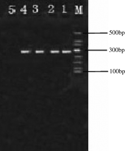 Figure 5.  Detection of NDV by PT-PCR. Lane M, 500 bp DNA marker; lanes 1 to 3, PCR product of liver of 1#, 2 and 3# infected birds; lane 4, positive control; lane 5, negative control.