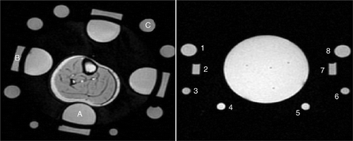 Figure 3. Left: Axial magnitude image of experimental setup and oil references for the MAPA experiments. A, one of four ‘inner’ references inside the D2O bolus; B, One of four ‘rect’ references outside water bolus; C, one of eight ‘outer’ oil references outside water bolus. Right: Axial magnitude image of experimental setup and eight oil references for the breast applicator experiments.