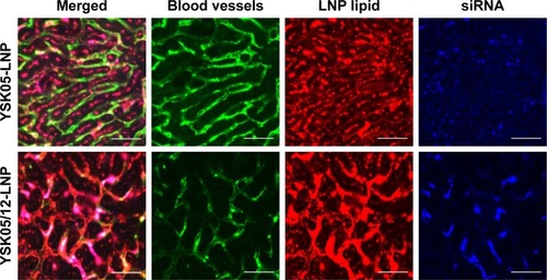 Figure 6 Intrahepatic distribution of YSK05-LNP (pKa 6.50) and YSK05/12-LNP (pKa 7.15).Notes: Mice were intravenously injected with DiI-labeled LNPs encapsulating a mixture of siRNA (siGL4:siCy5-GFP 1:1 ratio) at a dose of 0.5 mg/kg of both siRNAs. After 1 hour, liver tissues were collected and the distribution of LNPs was observed by CLSM. Green color represents blood vessels/LSECs (FITC-Isolectin B4), red color represents LNP (DiI), and blue color represents siRNA (Cy5). Scale bars: 50 µm.Abbreviations: CLSM, confocal laser scanning microscopy; FITC, fluorescein isothiocyanate; GFP, green fluorescent protein; LNP, lipid nanoparticle; LSECs, liver sinusoidal endothelial cells; siRNA, short interfering RNA.