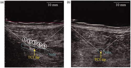 Figure 2. Longitudinal (a) and transverse (b) views of the positioning of the thermocouple TC1 in the vein. Spots are referred by their numbers.