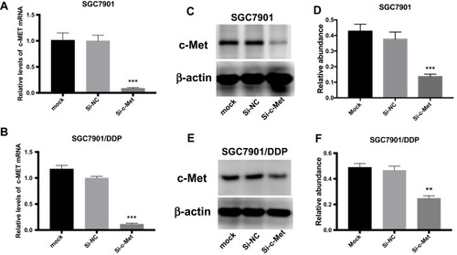 Figure 3 The role of si-c-Met. (A, B) qRT-PCR analysis was done to exam the inhibition to the expression level of c-Met mRNA. (C, D) Western blotting analysis was done to confirm the inhibiting effect of si-c-Met in gastric cancer cells. (E, F) Gray analysis of (C, D). **p < 0.01, and ***p < 0.001. All error bars stand for SE.