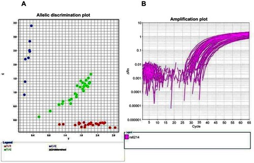 Figure 2 Allelic discrimination plot of (rs6214) gene polymorphism in both cases and controls, TT genotype (red dots),TC genotype (green dots) and CC genotype (blue dots) (A) and amplification plot (B).