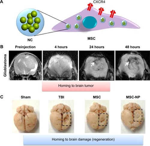 Figure 4 Improving the homing ability of engineered MSCs by uptaking IO-MNPs.Notes: (A) IO-MNPs NP selectively increased the expression of chemokine receptor CXCR4 in mMSCs. (B) MR images of targeted delivery of NC-labeled MSCs to orthotopic U87MG tumor (arrow). (C) The recovery of brain injury site (TBI model, dashed line box) after IV injection with unlabeled and NP-labeled MSCs. NP-labeled MSCs improved the homing ability toward the injury sites in the brain. Reprinted with permission from Huang X, Zhang F, Wang Y, et al. Design considerations of iron-based nanoclusters for noninvasive tracking of mesenchymal stem cell homing. ACS Nano. 2014;8(5):4403–4414. Copyright © 2014 American Chemical Society.Citation81Abbreviations: CXCR4, CXC chemokine receptor type 4; IO-MNP, iron-oxide magnetic nanoparticle; MR, magnetic resonance; MSC, mesenchymal stem cell; mMSC, mouse MSC; NC, nano cluster; NP, nanoparticle; TBI, traumatic brain injury.