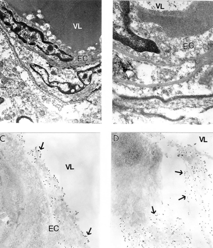 Figure 8 Electron microscopic determination of mitochondrial DNA signals visualized by using wild type and chimeric 5 kb deleted mtDNA probes in a human postmortem Alzheimer’s disease (AD) brain (A–B) and 24-month old AβPP-YAC transgenic mouse brain (C–D). A and B: AD brain microvessels endothelium and perivascular cells show clusters of wild type mtDNA containing positive signals visualized by indirect colloidal gold techniques (indicated by the dark dots). Original magnification: A and B ×10,000 and ×25,000, respectively. C–D: AβPP-YAC transgenic mice show the presence of clusters of chimeric 5 kb deleted mitochondria DNA positive signals throughout the matrices of vascular and perivascular cells (single arrows). Original magnification: C and D ×30,000 and ×20,000, respectively.