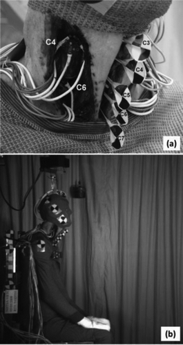 Fig. 3 Rear impact lab trial test: (a) C4 and C6 instrumentation and Steinmann pins with fiducials and (b) lateral view of test setup.