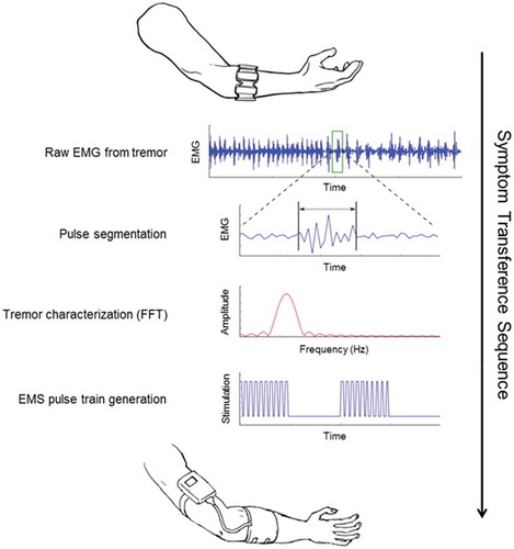 Figure 2. Sequence of the SymPulse™ tele-empathy symptom transference. EMG: Electromyography; EMS: electrical muscle stimulation; FFT: fast Fourier transform.