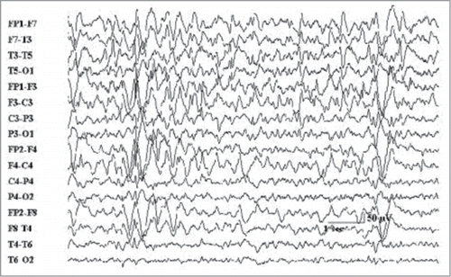 Figure 1. EEG experiment data.