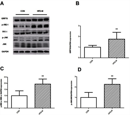 Figure 3 Effects of HFD-M on the expression of ER stress-related proteins in rat retroperitoneal fat tissue. (A) Representative GRP78, p-IRE1-α, p-JNK Western blots; Quantification of the Western blot membranes for (B) GRP78; (C) p-IRE1-α; (D) p-JNK. Data were presented as mean ± SD, n=6 each group; **P<0.01.