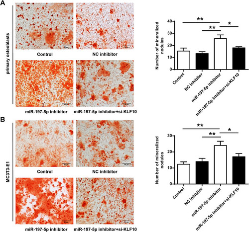 Figure 6 Mineralized nodules of primary osteoblasts and MC3T3-E1 cells. (A) Mineralized nodules of primary osteoblasts. (B) The mineralized nodules of MC3T3-E1 cells. N = 3. * P <0.05, ** P <0.01.