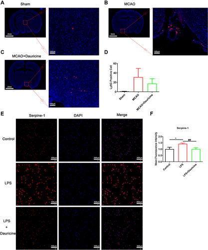 Figure 5 Dauricine reduces neutrophil infiltration into the MCAO-R brain, and inhibits the serpine1 activity and expression. Immunofluorescence staining of ly6G protein in mouse slices of sham (A), MCAO (B) and MCAO + dauricine (C), and the ly6G positive cells were counted (D). Microglia cell induced by LPS or dauricine for 3h, and stained with serpine1 and DAPI (E), mean fluorescence intensity of serpine1 was counted (F). n = 5 per group. Control group vs LPS group, *p < 0.05; LPS group vs (LPS + dauricine) group, ##p < 0.01; unpaired Student’s t-test.
