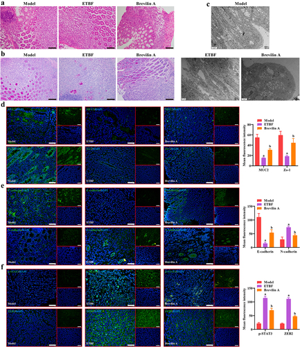 Figure 6. Effect of ETBF on colonic histopathology and protein expression. a: HE staining was performed to observe the pathological changes of colonic tissue in each group. Scale bar: 100 µm. b: changes in the number of goblet cells in colonic tissue were observed in each group using PAS staining. Scale bar: 100 µm. c: Representative TEM images of colon tissue from each group. Scale bar: 2 µm. d-f: effect of ETBF colonization and brevilin a treatment on the localization and fluorescence intensity of (d) intestinal mucosal barrier-related proteins (MUC2 and zo-1), (e) EMT-related proteins (E-cadherin and N-cadherin) and (f) STAT3/ZEB2 axis were observed by if staining in colon tissues. Scale bar: 50 µm. Compared to the Model group, ‘a’ represents p<0.05; compared to the ETBF group, ‘b’ represents p<0.05; and ns represents no significant difference.