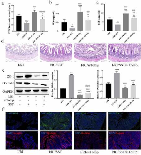 Figure 5. SST relieved intestinal epithelial barrier injury mediated by intestinal I/R inflammation by upregulating Tollip in rats. (a) The intestinal permeability detected by the content of FITC-dextran in serum. (b-c) Expression levels of the inflammatory factors IFN-γ and TNF-α in rat serum. (d) Representative images of rat intestinal tissues stained with H&E. Bars ‘ – ’ indicate 50 μm. (e) The expression of ZO-1 and Occludin in intestinal tissues. (f) Representative images of immunofluorescence staining of intestinal sections. Bars ‘ – ’ indicate 100 μm. I/RI, intestinal I/R injury group; I/RI/SST, I/RI with SST pretreatment; I/RI/siTollip, I/RI with siTollip injection; I/RI/SST/siTollip, I/RI with SST pretreatment and siTollip injection. n = 5 per group. One‑way ANOVA followed by Bonferroni post hoc test was used to compare the differences among different groups, ‘ns’ indicated no significance. nsP>0.05, *P < 0.05, **P < 0.01, ***P < 0.001, ****P < 0.0001 vs. I/RI group; #P < 0.05, ##P < 0.01, ###P < 0.001, ####P < 0.0001 vs. I/RI/SST group; @@P < 0.01, @@@P < 0.001, @@@@P < 0.0001 vs. I/RI/siTollip group.