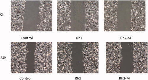 Figure 5. Representative micrographs pictures of A549 scratch assays at 0 h and 24 h.