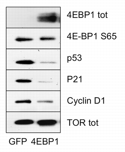 Figure 6. Overexpression of 4E-BP1 results in downregulation of p53, p21 and Cyclin D1. SDS-PAGE western blot of BJ cells at passage 35, transiently transfected with GFP or 4E-BP1.