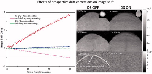 Figure 7. Correction of phase-induced image shift using F0 dynamic stabilisation (DS). In the absence of DS, there is a gradual shift in image position along the phase encoding direction over time, corresponding to approximately 1 mm after 15 min of scanning (upper curve, red). A negative shift (<0.5 mm after 30-min scan) is observed along the frequency encoding direction (lower curve, pink). Both image shifts are corrected after applying DS (middle curves, blue and green). Right panel are corresponding magnitude maps showing the position shift over time with DS turned on/off.