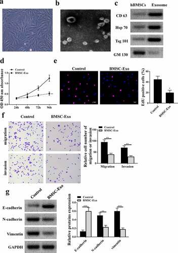 Figure 3. HBMSCs-derived exosomes inhibited the progression of LNCaP cells. (a) The morphological characteristics of HBMSCs by the inverted microscope. (b) The ultrastructure of exosomes by a transmission electron microscope (TEM). (c) The analysis of exosomes by Western blot to detect relative exosomes-related markers. (d-g) LNCaP cells were treated with HBMSCs-derived exosomes for different times (CCK-8 assay), EdU assay and Transwell assay (72 h). (d) The cell viability of LNCaP cells by CCK-8 assay. (e) The proliferation of LNCaP cells by EdU staining assay. Scale bar = 40 μm. (f) The migration and invasion of LNCaP cells by Transwell assay. Scale bar = 100 μm. (g) The expression of exosomes related markers was analyzed by Western blot analysis. ** p < 0.01, *** p < 0.001.