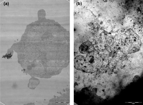 Figure 4. TEM images of (a) healthy and (b) damaged HL-60 cell interacted with complementary nanotheranostic system.