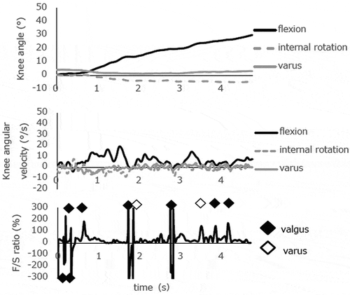 Figure 4a. Knee biomechanics during a slow, single-leg squat from 0° to 30° knee flexion in subject 1. Quantitative analysis of the F/S spikes detected valgus KW 4 times at 0-5° knee flexion, one valgus KW and one varus KW at 10-15° knee flexion during the descending phase of the first squat. This case presented more valgus KW than varus KW