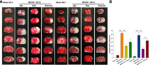 Figure 6 Effects of compound C (CC) on MCAO-induced cerebral infarction. (A) TTC-stained coronal sections from representative rats from each group at 24 h and 48 h. (B) Quantitative analysis of the cerebral infarct volume. The data are expressed as the mean ± SD (n = 5). **p < 0.01, ***p < 0.001 by ANOVA with Bonferroni test for post hoc comparisons.