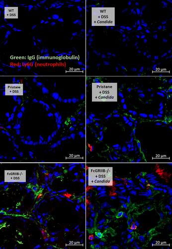 Figure 5 Representative pictures of immunofluorescent stained sections for colon injury as determined by immunoglobulin G (IgG deposition) (green color of Alexa Fluor 488) and neutrophil accumulation (Ly6G) (red color of Alexa Fluor 647) of mice from wild-type (WT), Pristane and FcGRIIB-/- group after the administration of dextran sulfate solution (DSS) alone or with Candida gavage (DSS + Candida) (original magnification 630x) are demonstrated. Colon pictures from mice with control water in WT, Pristane and FcGRIIB-/- group are not presented due to the similarity to the represented pictures of WT+DSS and WT+DSS+Candida.