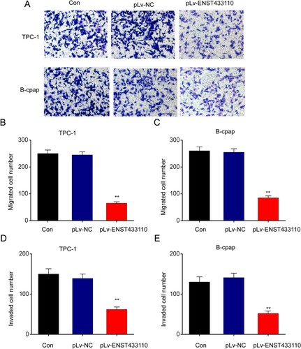Figure 3. Overexpression of lncRNA ENST433110 suppresses TC cell migration. A–C, (A) Transwell assay was used to evaluate the effect of lncRNA ENST433110 overexpression on TPC-1 (B) and B-CPAP (C) cell migration. Representative images are shown. Scale bars = 100 µm. Data are represented as the mean ± SEM of three independent experiments. **P < 0.01 vs. pLv-NC.