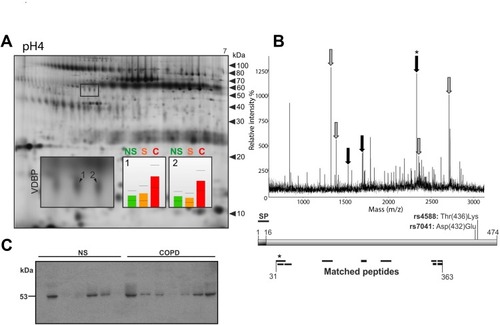 Figure 2 Secreted VDBP is upregulated in the sputum of smokers with COPD.Notes: (A) Representative 2D gel of the sputum from a characteristic COPD patient (stage II). Altered protein spots of VDBP indicated by 1 and 2. Histogram corresponding to the spot numbers indicates the protein levels in non-smokers (NS), smokers (S) and COPD patients (C). (B) A representative mass spectrum (MS) of the altered VDBP. Peptides marked with grey arrows matched to all three isoforms whereas the black arrows matched only to isoforms 1 and 3. The schematic presentation of VDBP shows the signal peptide (SP) and the sequence coverage of the spot-specific peptides detected by MS. The N-terminal peptide of the mature VDBP indicated by an asterisk. (C) Western blot of the sputum from non-smokers (NS, n = 7) and smokers with COPD stage II (COPD, n = 7).