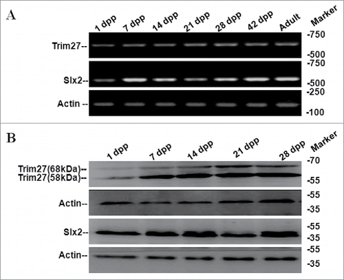 Figure 1. Expression of mouse Trim27 and Slx2 detected by RT-PCR and western blotting. (A)Trim27 and Slx2 expression were investigated in multiple developmental stages in mouse testis tissue by RT-PCR, and expression was high in various different stages. (B) Trim27 and Slx2 proteins were detected by Western blotting following immune precipitation. Two distinct bands of Trim27 were detected that correspond to 58 kDa and 68 kDa proteins.