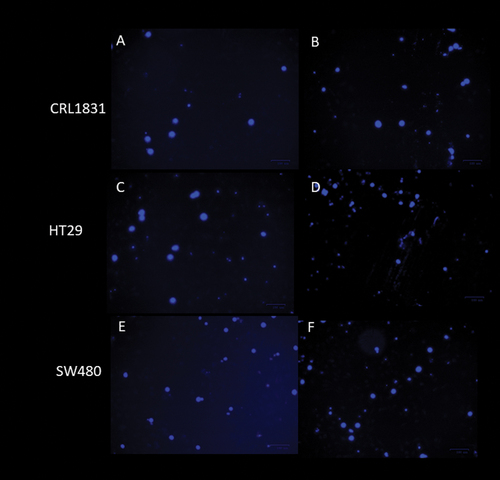 Figure 5. Detection of apoptotic cells by DAPI staining, a) CRL1831 cells control, at 0 h, b) CRL1831 cells, with 5 mg/mL of 0.5/0.5 agave/inulin at 120 h, c) HT29 cells control, at 0 h, d) HT29 cells with 5 mg/mL of 0.5/0.5 agave/inulin at 120 h, e) SW480 control cells, at 0 h, f) SW480 cells with 5 mg/mL of 0.5/0.5 agave/inulin at 120 h.