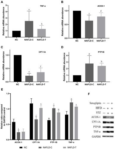 Figure 6 Effect of DPP4i treatment on liver (A) TNF-α mRNA expression, (B) ACOX-1 mRNA expression, (C) CPT-1A mRNA expression, (D) PTP1B mRNA expression, (E) Effect of DPP4i treatment on liver ACOX-1, CPT-1A, PTP1B, TNF-α protein expression; (F) Western blot analysis of liver ACOX-1, CPT-1A, PTP1B, TNF-α expression. a: NAFLD-C group vs. NC group P < 0.05; b: NAFLD-C group vs. NAFLD-T group P < 0.05; c: NAFLD-C group vs. NC group P < 0.05; d: no significant difference between NAFLD-C and NAFLD-T group; e: NAFLD-C group vs. NC group P < 0.05; f: NAFLD-C group vs. NAFLD-T group P < 0.05; g: NAFLD-C group vs. NC group P < 0.05; h: NAFLD-C group vs. NAFLD-T group P < 0.05; i: NAFLD-C group vs. NC group P < 0.05; j: NAFLD-C group vs. NC group P < 0.05; k: NAFLD-C group vs. NAFLD-T group P < 0.05; l: NAFLD-C group vs. NC group P < 0.05; m: NAFLD-C group vs. NAFLD-T group P < 0.05; n: NAFLD-C group vs. NC group P < 0.05; o: NAFLD-C group vs. NAFLD-T group P < 0.05.