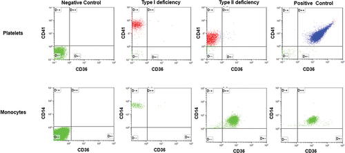 Figure 1. Flow cytometry analysis of CD36 expression on platelets and monocytes. Top panels: Platelets from a normal individual (positive control); individuals with types I and II deficiencies were stained with fluorescence-labeled anti-CD41 (PE) and anti-CD36 (FITC). After washings, platelets were subjected to flow cytometry analysis using unlabeled platelets as negative controls. Bottom panel: monocytes were isolated from the same individuals and labeled with fluorescence anti-CD14 (PE) and anti-CD36 (FITC) and subjected to flow cytometry analysis as above.