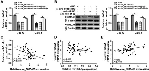 Figure 7 Circ_0035483 could regulate HMGA1 by serving as a sponge of miR-31-5p (A and B) After 786-O and CaKi-1 cells were transfected with si-circ_0035483#2, si-circ_0035483#2+anti-miR-31-5p or the corresponding controls, the detection of HMGA1 mRNA and protein expression was performed using qRT-PCR and Western blot. (C–E) The linear correlations among circ_0035483, miR-31-5p and HMGA1 expression in RCC tissues were analyzed by Pearson’s correlation coefficient. *P < 0.05.