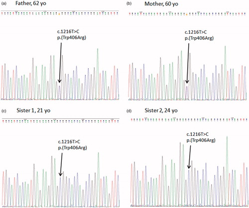 Figure 2. Parents exhibit the same mutation as asymptomatic heterozygotes panels (a) and (b), thereby confirming the homozygosity found in the sisters’ panels (c) and (d).