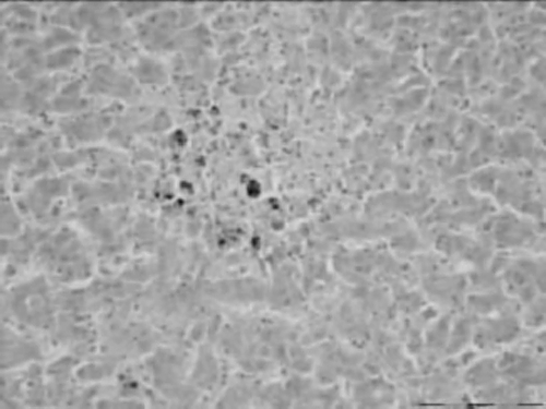 Figure 6.  Immunohistochemical detection of avian reovirus. Viral antigen was detected in mononuclear cells of the liver in areas with necrosis. ABC method, ×200.