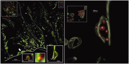 Figure 4. Left: A: Maximum-intensity projection of the Hensen cell (HC) region in the human organ of Corti. Cx30-positive intercellular GJ plaques dominate. Some GJs seem to face the BM (filled arrow). Cx26-expressing GJ plaques are located near the Cx30 plaques (inset top left). Framed areas are magnified in insets A and B. Annular GJ plaques with Cx26 expressed inside can be seen. B: An annular GJ surrounds smaller dots of Cx26 staining. One is superimposed (yellow) on the Cx30 plaque and is shown in higher magnification in B. Right: A 3-D reconstruction of Cx26 (red) and Cx30 (green) protein expression is shown in B. The green signal was reconstructed in surface rendering mode, and the red signal was rendered in spot detection mode using Imaris 8.2 software. The inset demonstrates the GJ complex after clock-wise rotation. A single optical plane with orthogonal sectioning is shown in the Supplementary material. BM: basilar membrane.