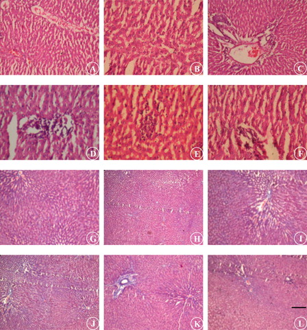 Figure 6. Photomicrograph of liver section staining with H & E (A–F; 10×) and MT (G–L; 10×). UNX-control (A and G), UNX-control treated with morin alone (50 mg/kg) (B and H), DOCA-salt hypertensive rats (C–E and I–K) and DOCA-salt rats treated with morin (50 mg/kg) (F and L). Scale bar: 5 µm.